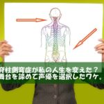 脊柱側弯症が私の人生を変えた？舞台を諦めて声優を選択したワケ。